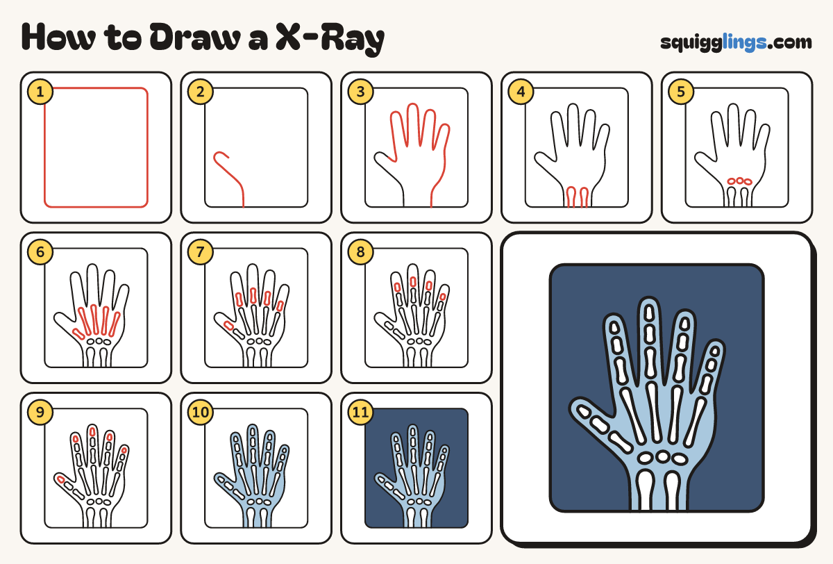 How to Draw a X-Ray step by step: all 11 steps in one picture
